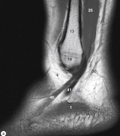 <p>13</p>