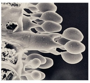 <p>Basidiospores</p>