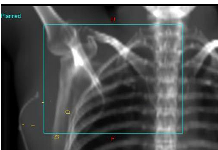 <p>what are the yellow contours on the image?</p>