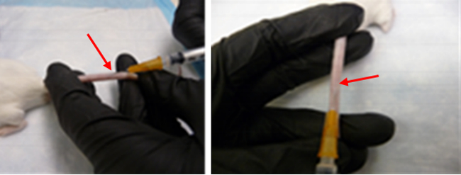 <p>Intravenous (IV)</p>