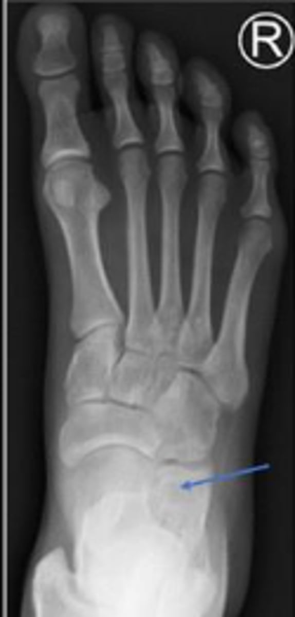 <p>What are the arrows pointing to?</p>