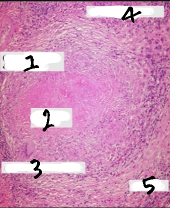 <p>Identify and What are the microscopic components ?</p>