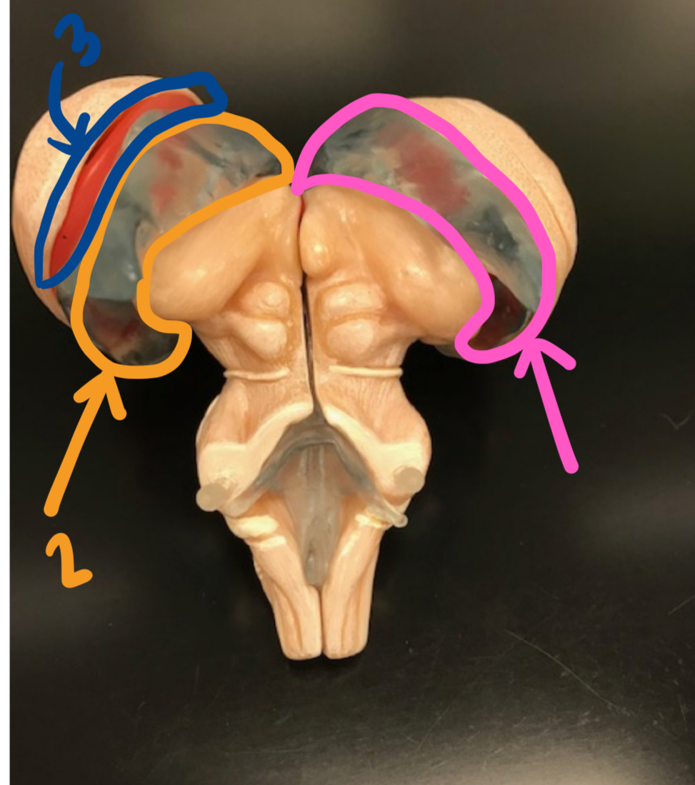 <p><strong>open spaces of the brain + the spine</strong></p><p>what are structures 1-3?</p>