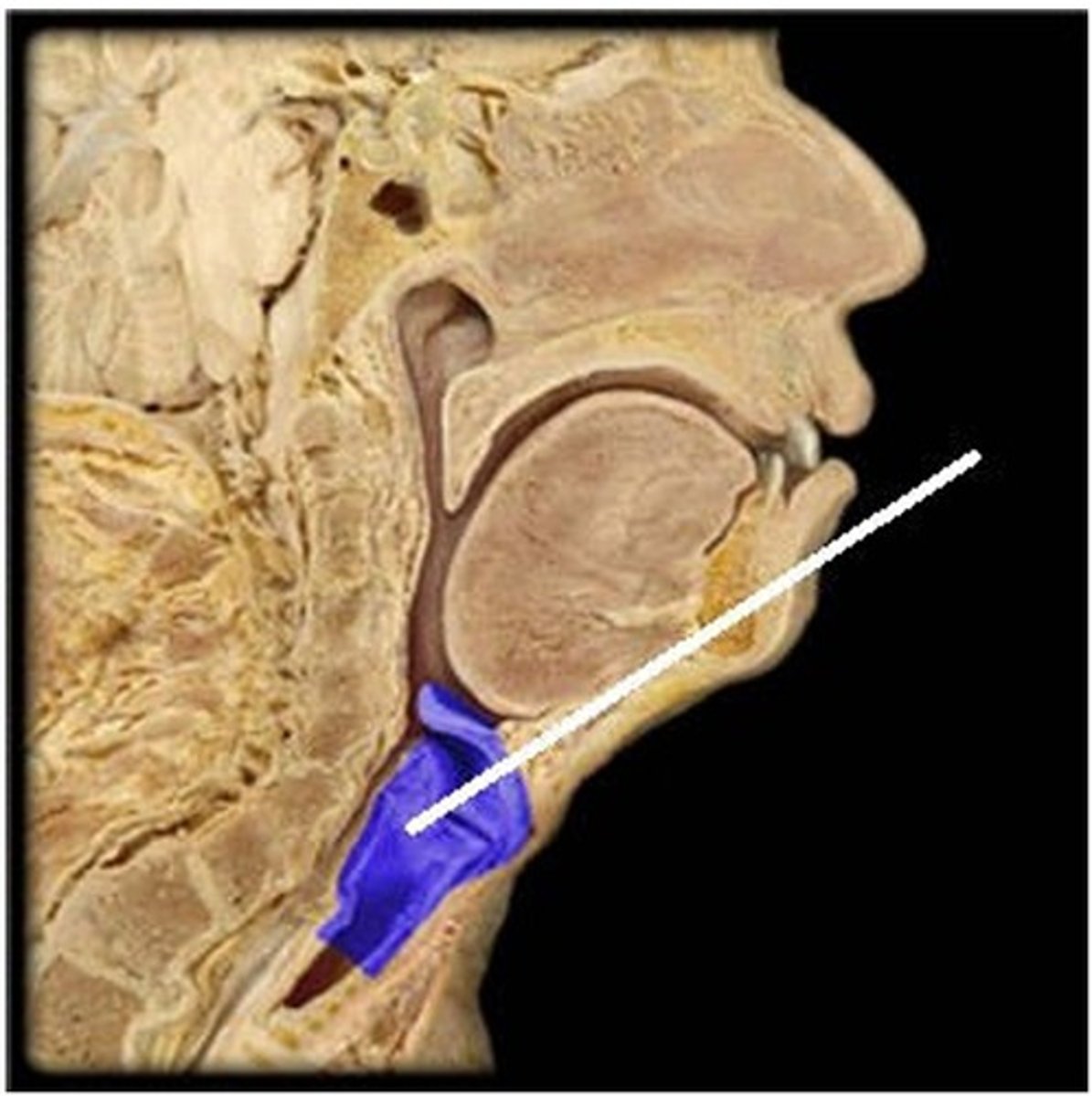 <p>Which structure is highlighted (reference leader line)?</p><p>A) primary bronchus</p><p>B) nasal concha</p><p>C) esophagus</p><p>D) pharynx</p><p>E) larynx</p>