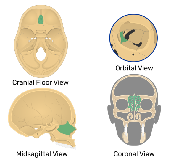 <p>What bone structure is the highlighted area?</p>
