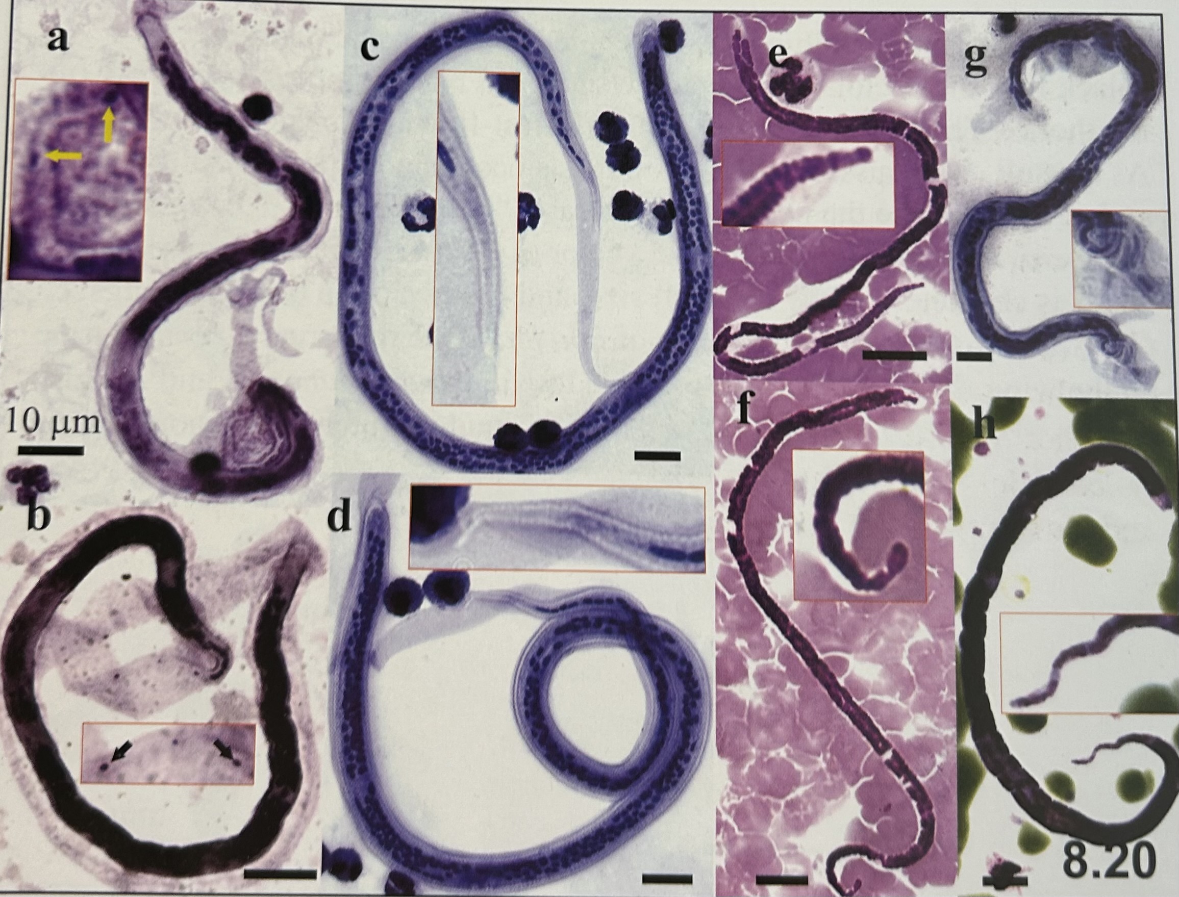 <p>characteristics of microfilariae in peripheral blood smears?</p>
