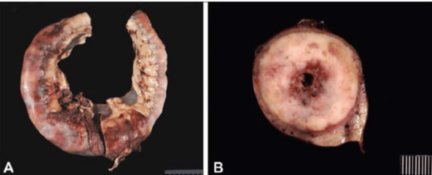 <p>How is Pythiosis going to be DX?</p>