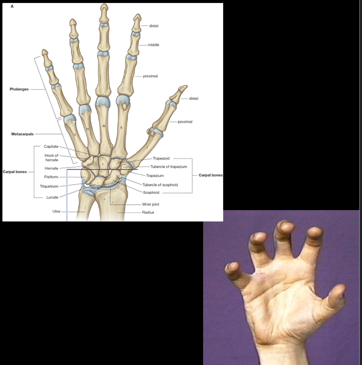 <p>These joints are between the phalanges, so phalange to phalange. </p><p>They are hinge joints (again, synovial) and perform flexion and extension. </p><p>These joints are supported by your lateral/medial collateral ligaments as well as your palmar ligaments.</p>