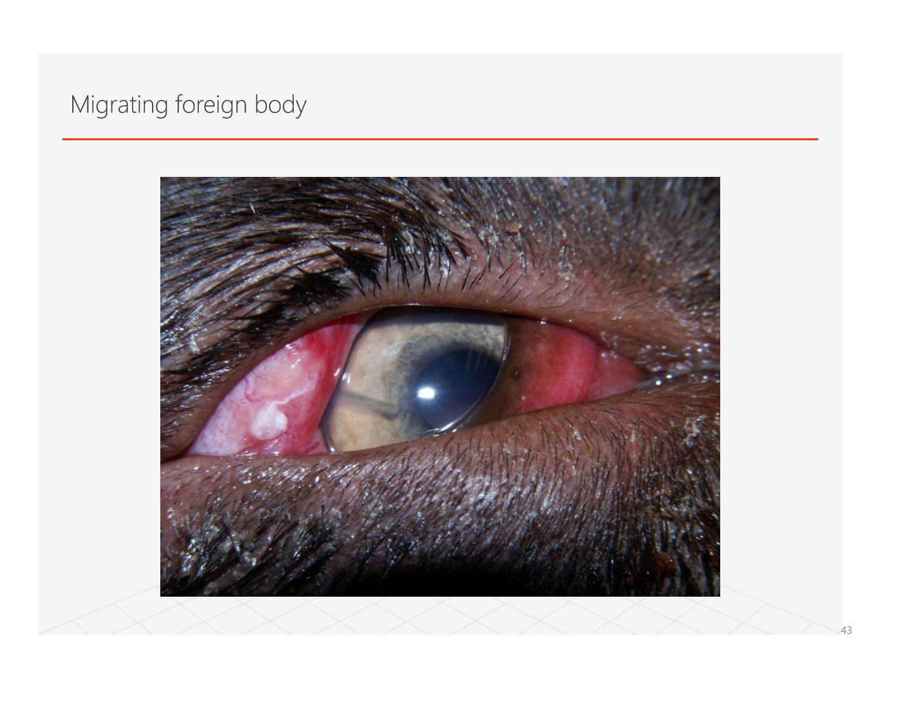 <p>an eyelash foreign body</p>