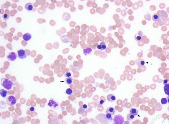 <p>Identify the disease and the cause</p>