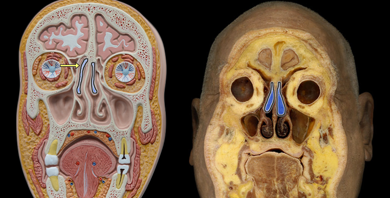 <p>Middle nasal concha</p>