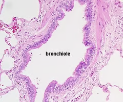 <p>-lumen lined with ciliated simple columnar epithelium to ciliated simple cuboidal epithelium </p><p>-layer of smooth muscle</p>