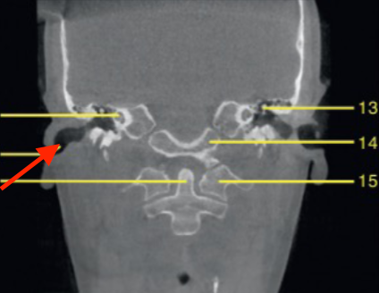 <p>identify the structure </p>