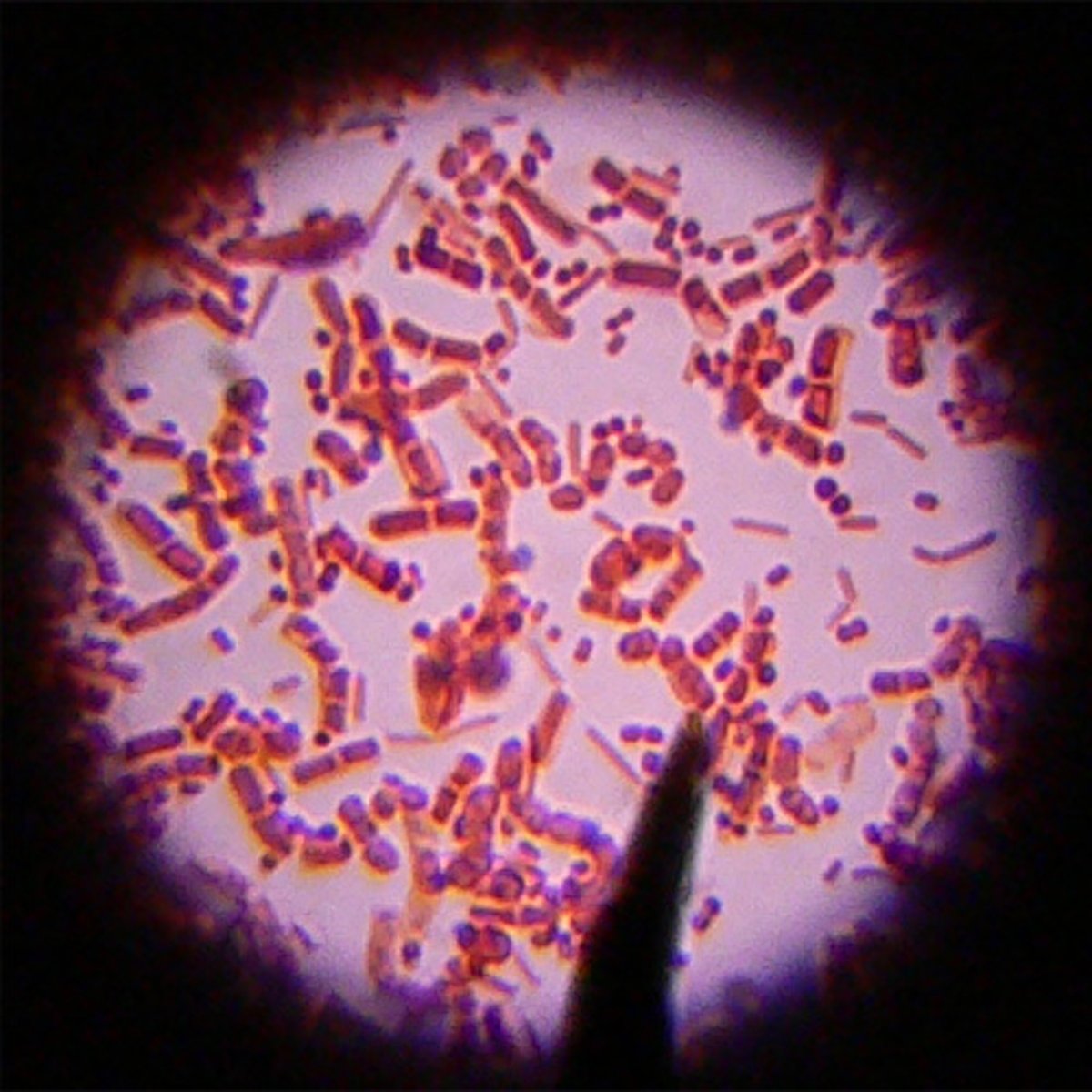 <p>Bacteria that retain a red-pink color. These bacteria have a thin membrane of peptidoglycan, sandwiched between an outer membrane and an inner membrane.</p>