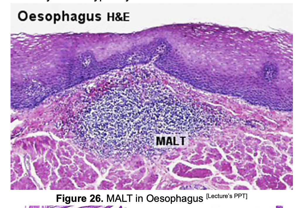 <ol><li><p><strong>Esophagus&nbsp;</strong></p></li><li><p><strong>Colon</strong></p></li></ol><p></p>