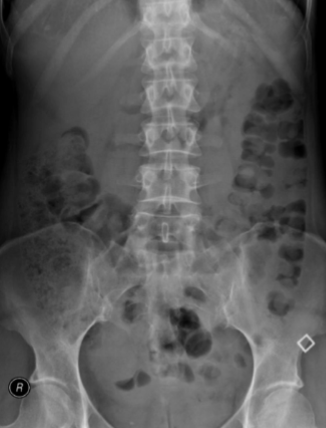 <p>What is this and what type of scan </p>