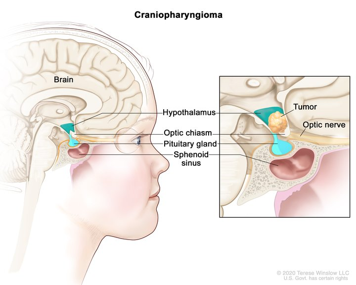 <p>pituitary gland</p>