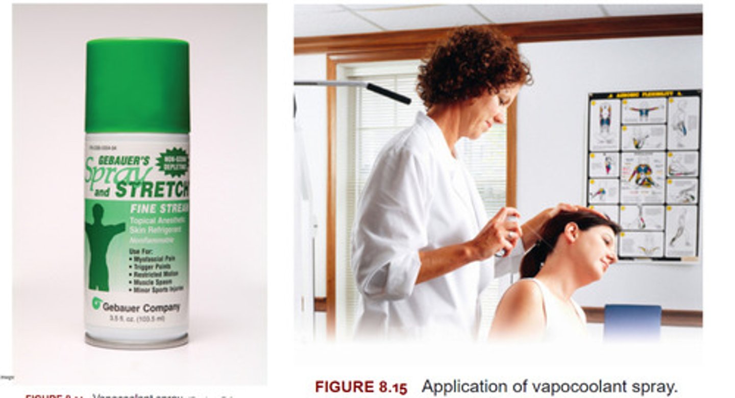 <p>"Stretch is the Action spray is the distraction"</p><p>Used to treat Trigger Points</p>
