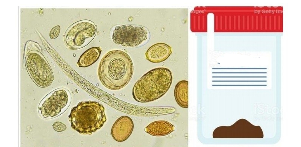 <p>Identify </p>