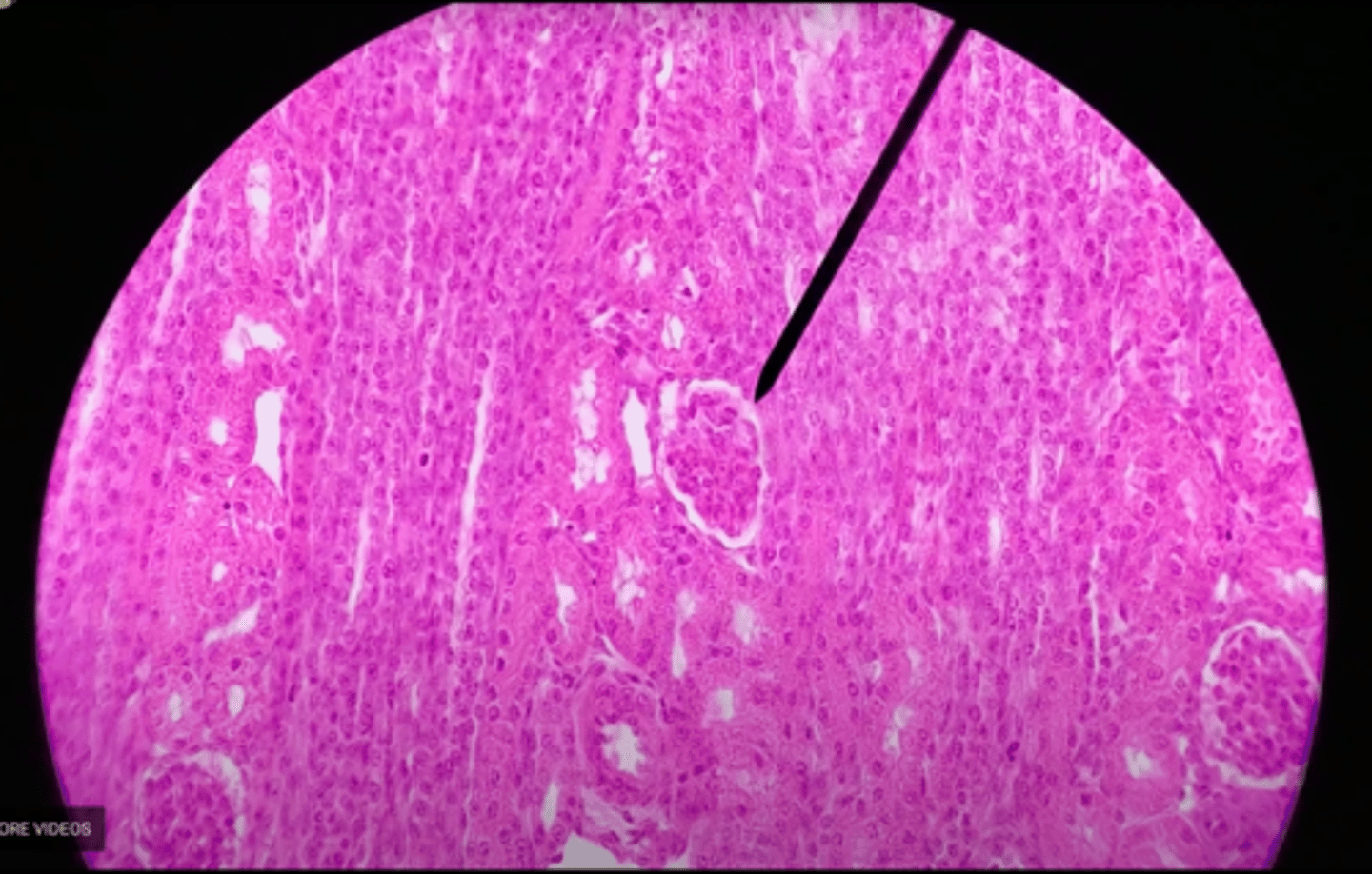 <p>the functional unit of the kidney</p>