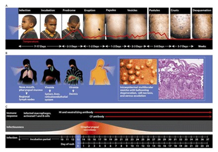 <p>Poxvirus inhaled, prodromal period in which you feel sick, continuum of rashes</p>