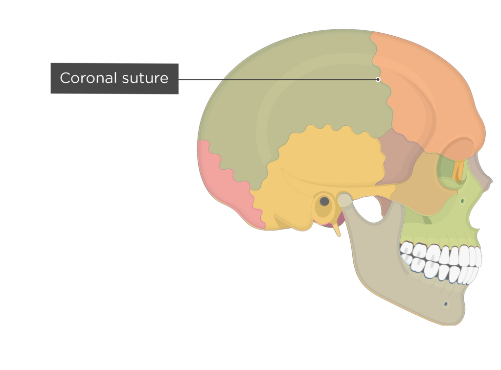<p>[BONES TO KNOW; suture] separates the <u>frontal bone</u> from the <u>parietal bone</u>.</p>