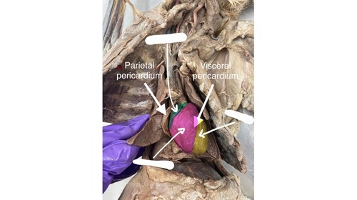 <p>(highlighted green)</p>
