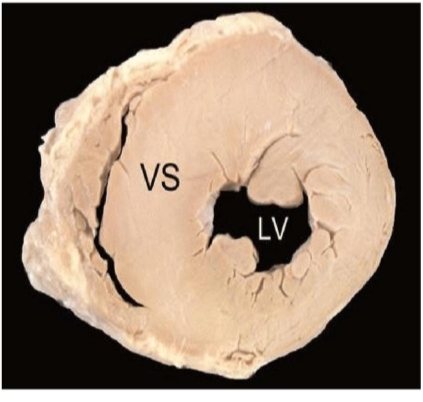 <p>What happened?and what is the reason?</p><p>And is it reversible or irreversible ?</p>