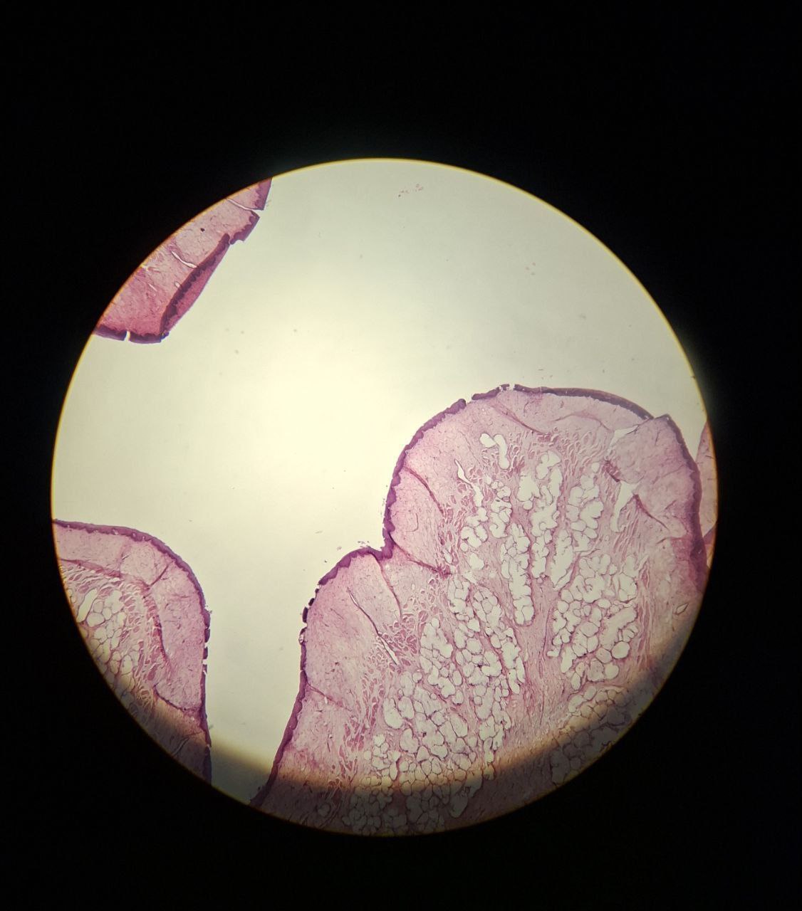 <p>Identify this tissue and mention one site</p>