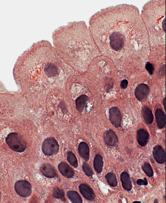 <p>What type of epithelium is shown?</p>