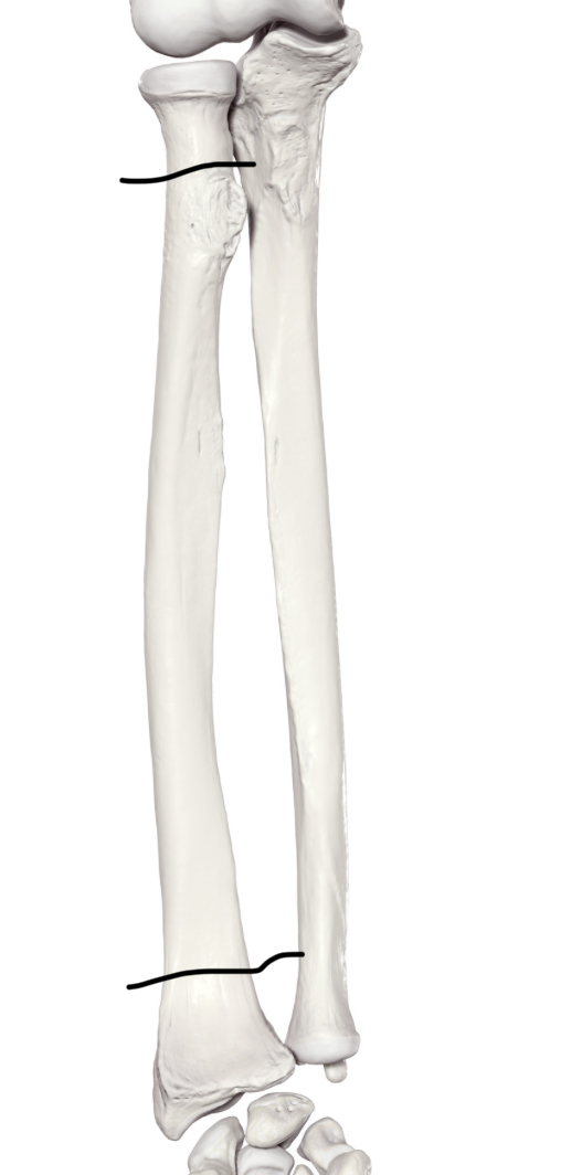 <p>Hoe heet dit deel?</p>