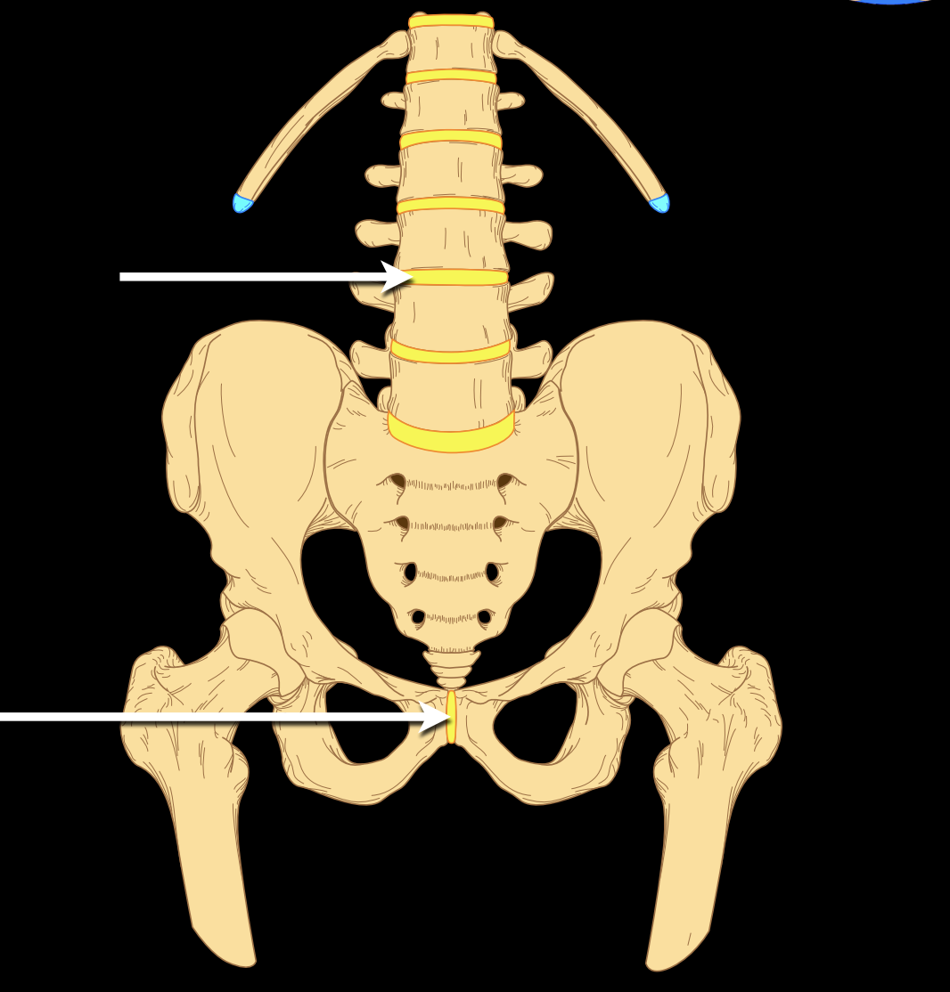 <p>What type of joint and subtype</p>