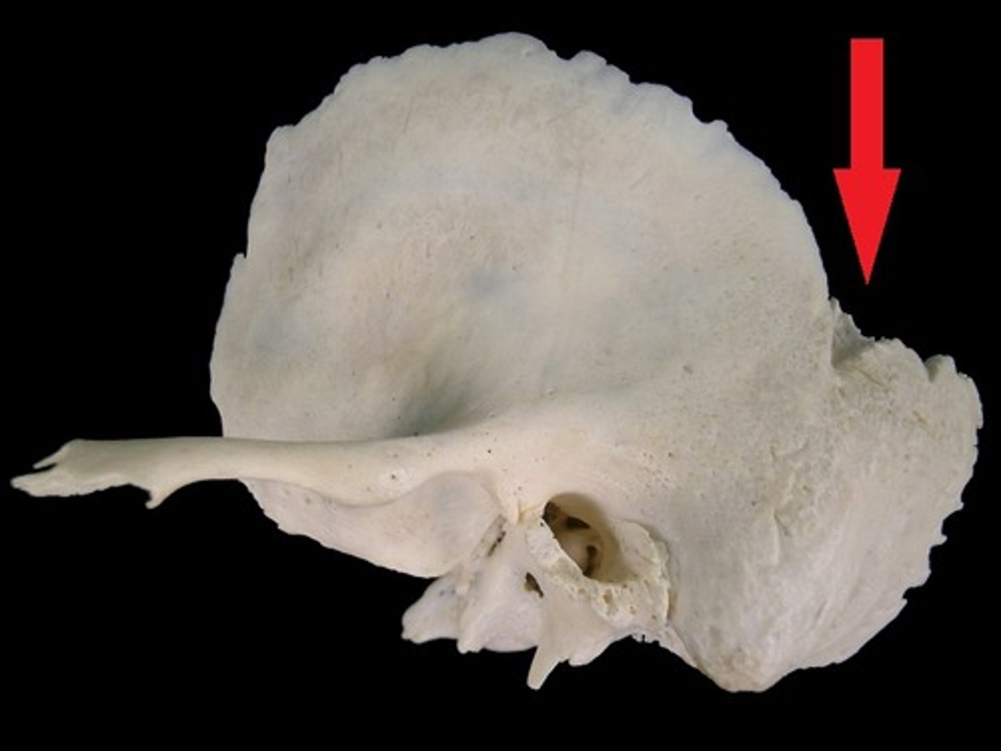 <p>formed by the posterosuperior border of the TEMPORAL, where the squamosal and parietomastoid sutures meet</p>