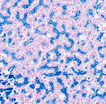 <p>Prussian blue stains iron stores; what would you report this iron store 0-4+? </p>