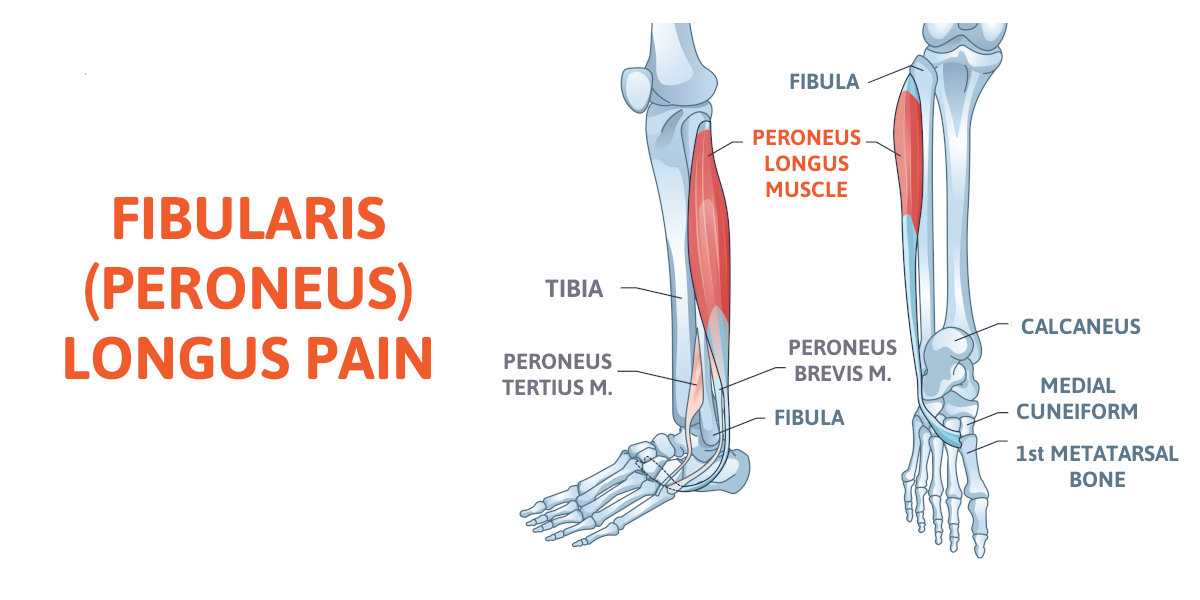 <p>Peroneus longus</p>