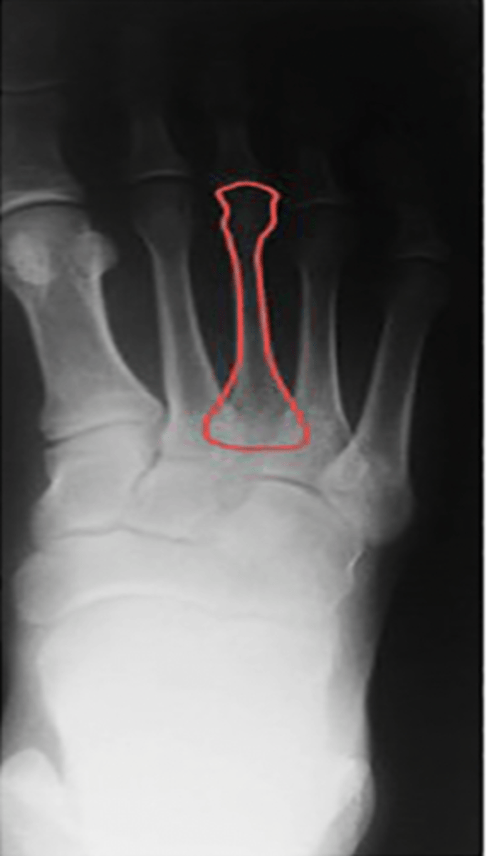 <p>What structure is highlighted?</p>