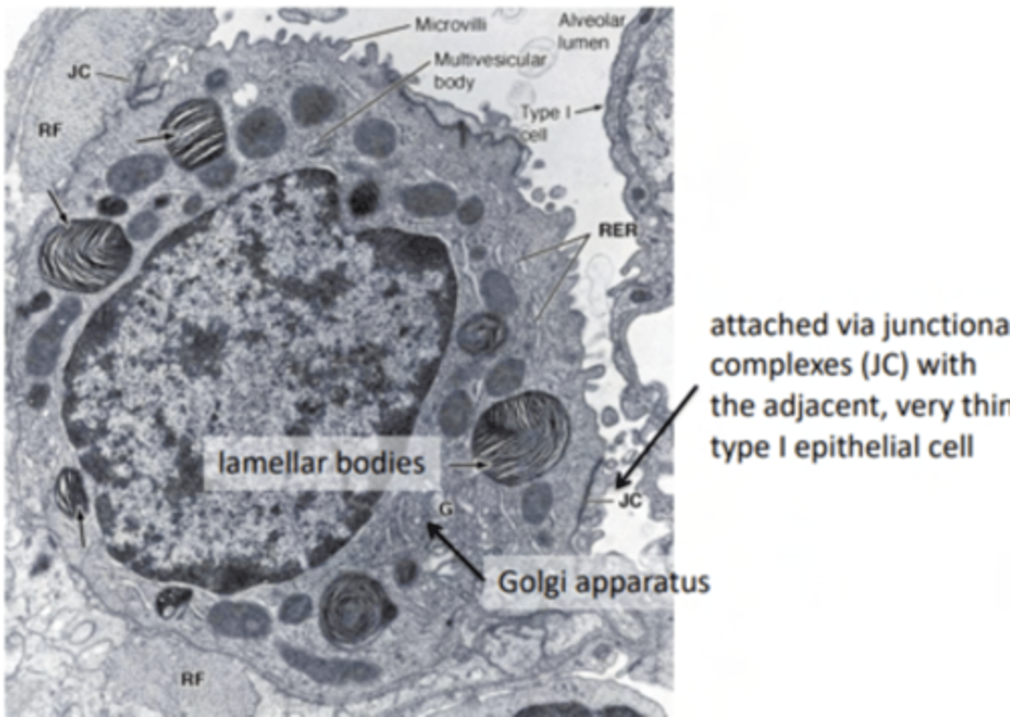 <p>large and rounded cells with a vacuolated cytoplasm (filled with small vacuoles or spaces).</p>