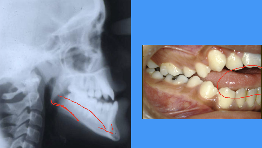 <p>(not same radiograph and clinical image) </p>