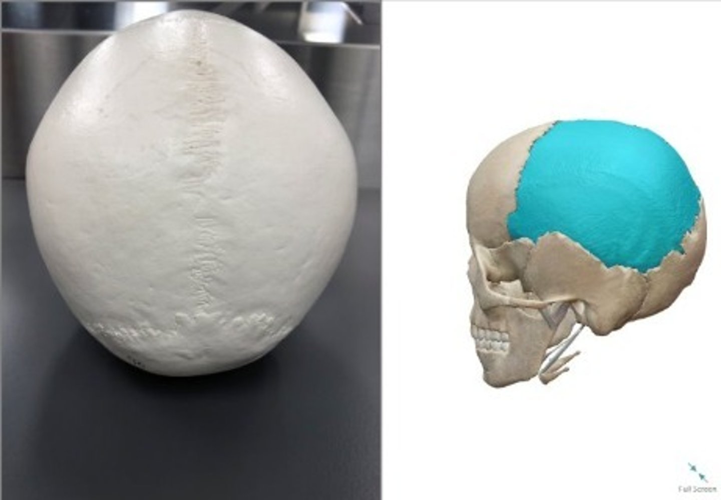 <p>What category of bone is this? What bone is this?</p>
