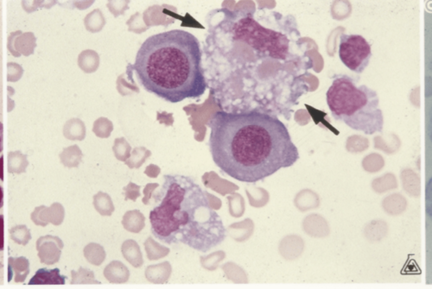 <p>Identify the cells in this body fluid</p>