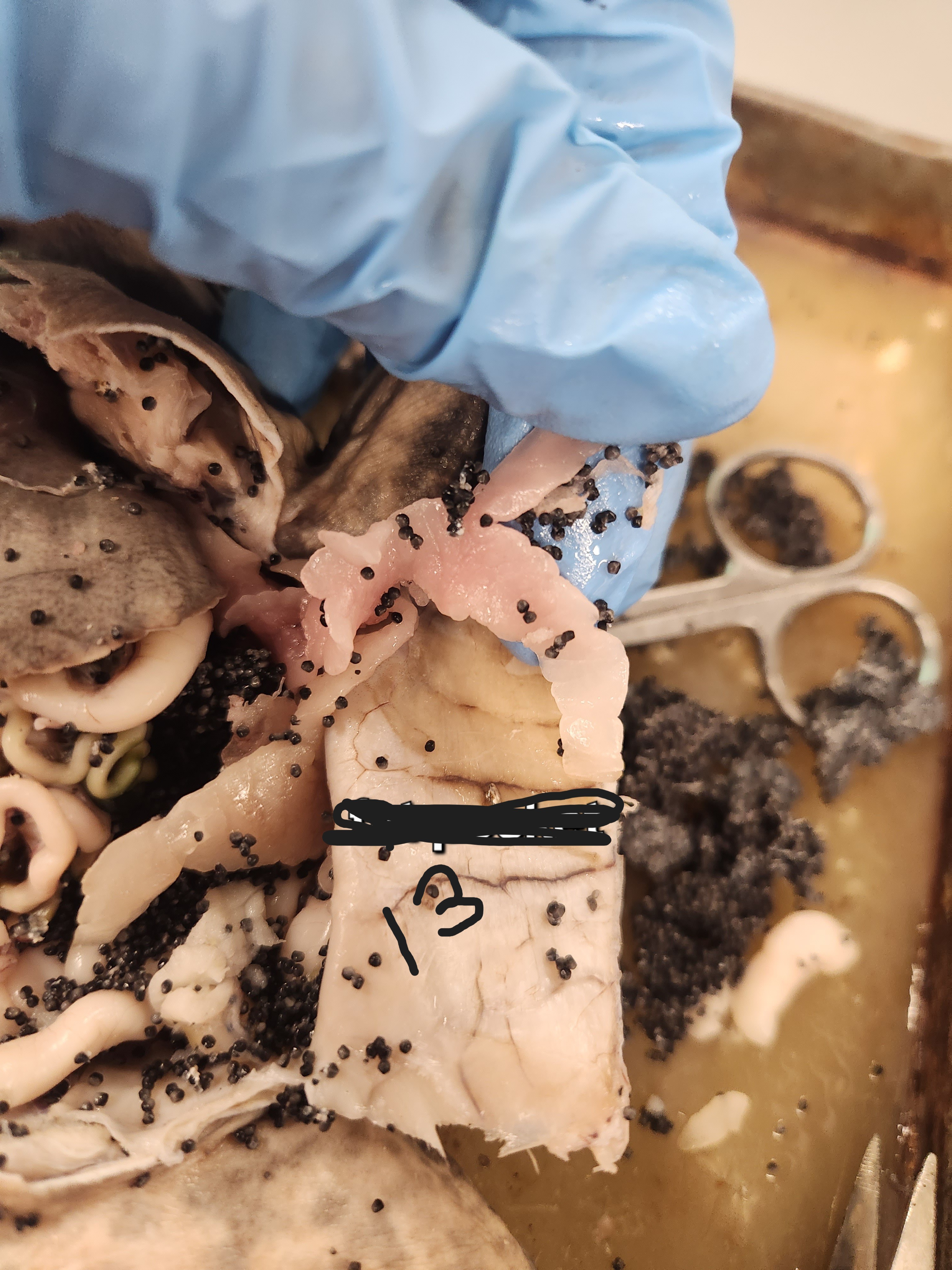 <p>What is option 13</p>