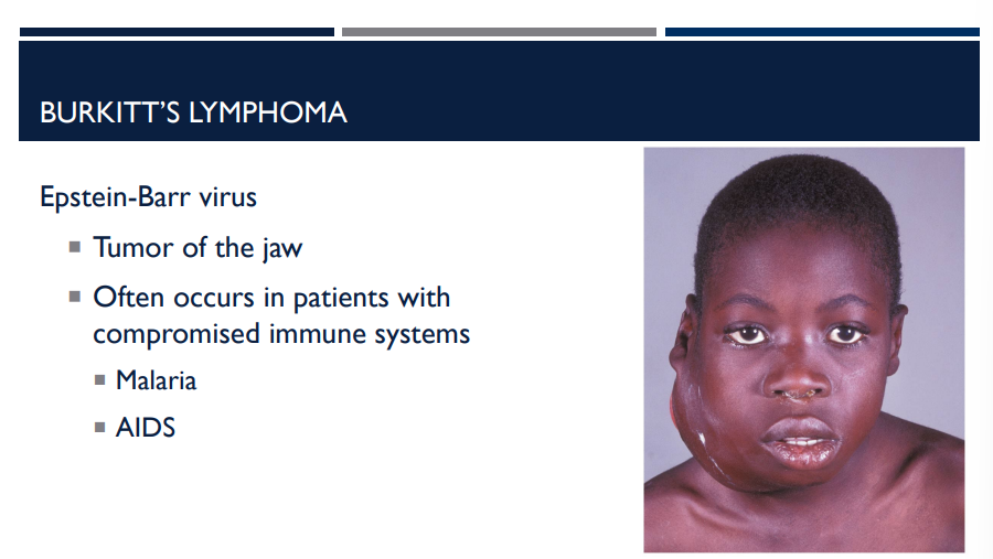 <p>What is Burkitt’s lymphoma and the virus it is caused by? In what types of patients does it occur in?</p>