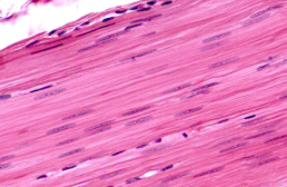 <p>Characteristic: INVOLUNTARY, NO striations, uninucleate, </p><p><strong>Function: CONSTRICT BLOOD VESSELS/ORGANS</strong></p><p><strong>Location: INTERNAL ORGANS (digestive tract)</strong></p><ul><li><p>NO STRIATIONS</p><ul><li><p>NOT WAVY unlike dense regular connective tissue</p></li></ul></li></ul><p></p>