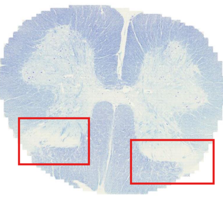 <p>what is this?</p><p>what neurons are here?</p>