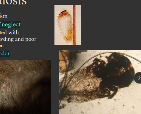 <p><span>Pediculosis (Lice)</span></p>