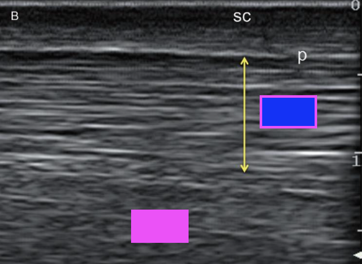 <p>what type of ultrasound scan does this show?</p>
