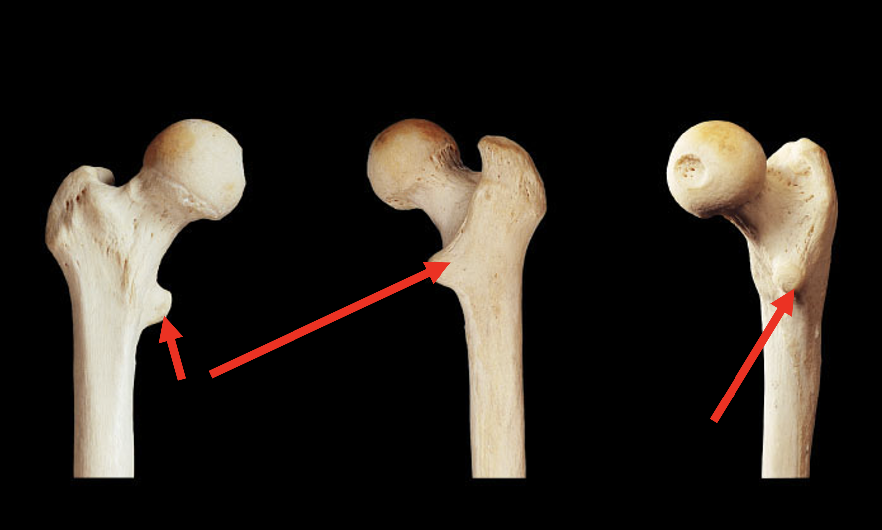 <p>Name this region of the femur</p>