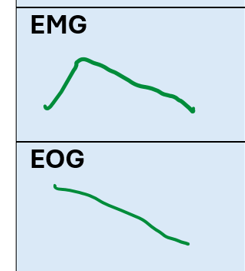 <ul><li><p>EMG: No–low activity (lowest)</p></li><li><p>EOG: High activity</p></li></ul><p></p><p></p><p></p>