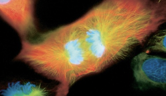 <p>connections between centromeres severed, chromatids move to opposite poles</p>