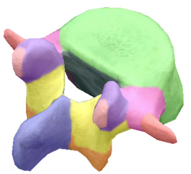 <p>What are the pedicles located on the lumbar spine vertebra?</p>